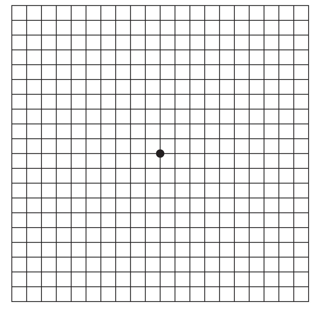 How to Use the Amsler Grid to Test Your Vision