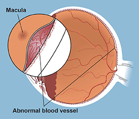 The macula is a small area of the retina located directly at the back of the eye. While the entire retina receives light rays, the macula is responsible for central vision, including fine detail and colors.