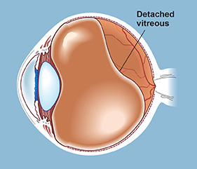 The vitreous is a jelly-like substance between the lens and the retina that makes up most of the volume of the eye.